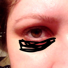 Actual representation of the dark circles under my eyes